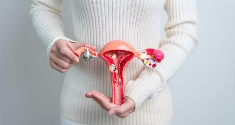 Can UFE Treat Multiple or Large Fibroids Effectively? Real Outcomes Explained
