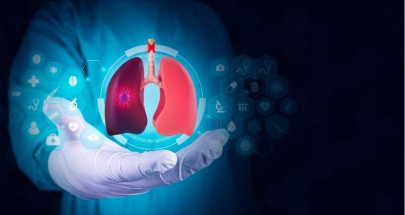 Cryobiopsy for Lung Disease