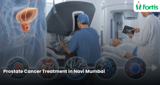 Best Prostate Cancer Treatment in Navi Mumbai
