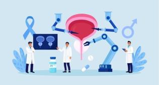 Choosing the Right Cancer Center for SBRT