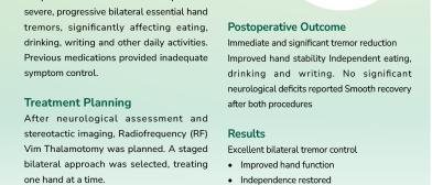 RADIOFREQUENCY ABLATION FOR SEVERE BILATERAL HAND TREMORS