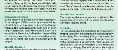 AORTIC ROOT REPLACEMENT (BENTALL'S PROCEDURE) FOR IMPENDING RUPTURE OF SINUS OF VALSALVA