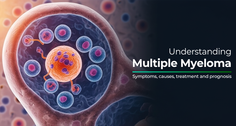 Best Multiple Myeloma Treatment in Mumbai | Blood Cancer Diagnosis ...