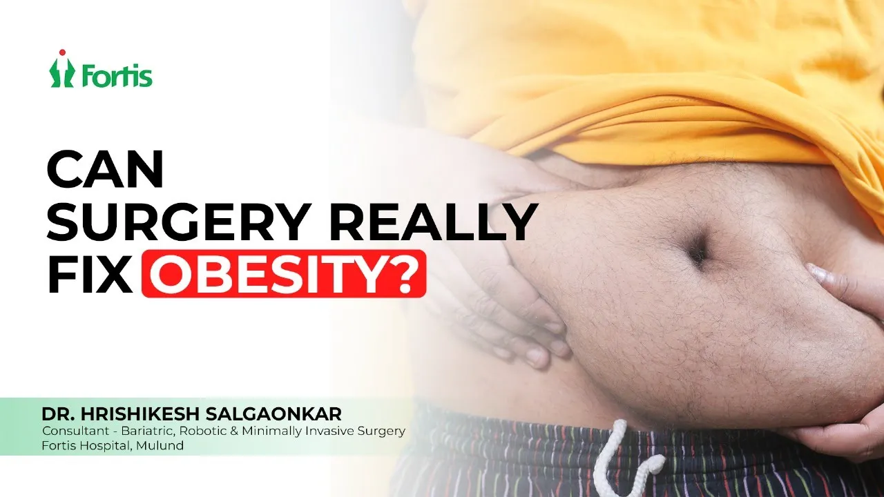 Is Bariatric Surgery an Easy Solution for Obesity? 