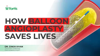 What is Balloon Angioplasty? Treating Heart Blockages Without Major Surgery