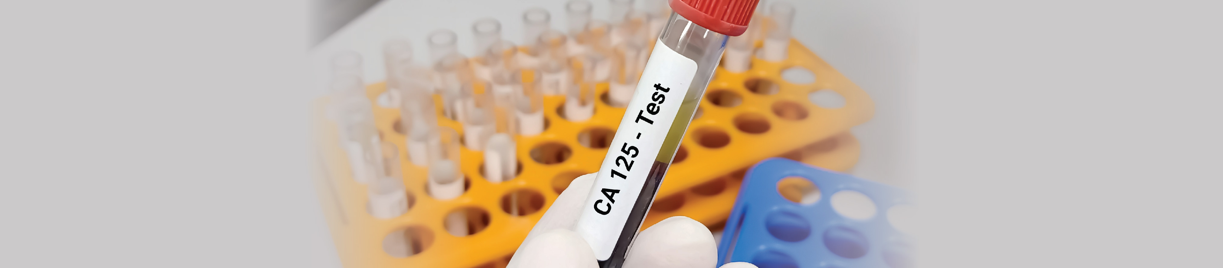 CA 125 Test | Fortis Healthcare