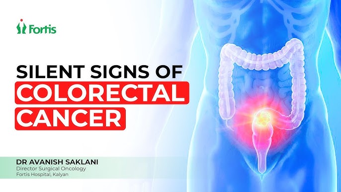  Common Colorectal Cancer Symptoms People Ignore | When to Get Checked Early | Dr Avanish Saklani