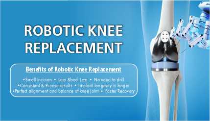 Robotic Knee Replacement