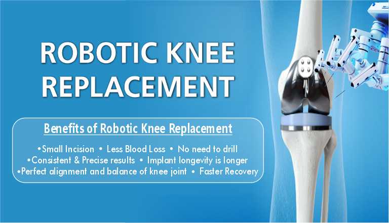 Robotic Knee Replacement