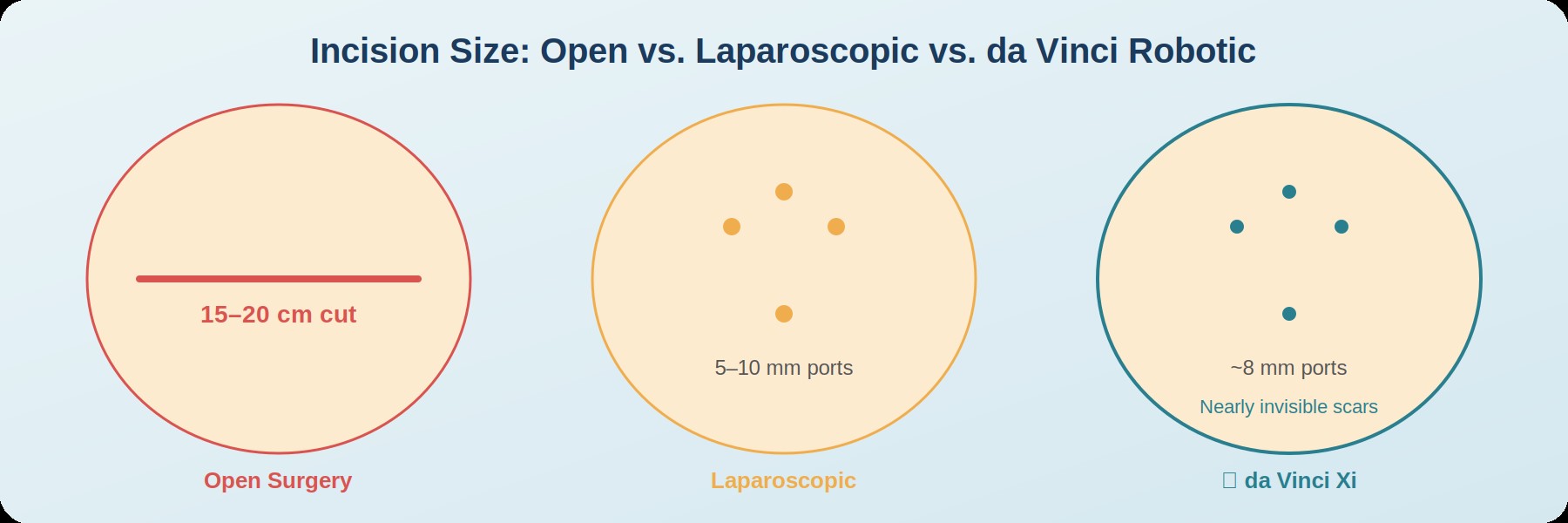 Incision Size Comparison