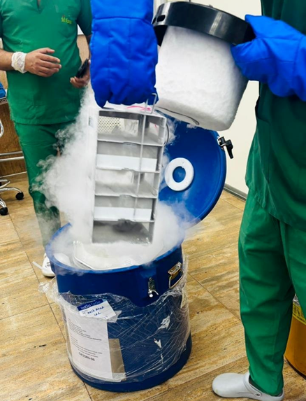 Cryopreserved allogeneic stem cells being prepared for treatment at Fortis Hospital Mohali.