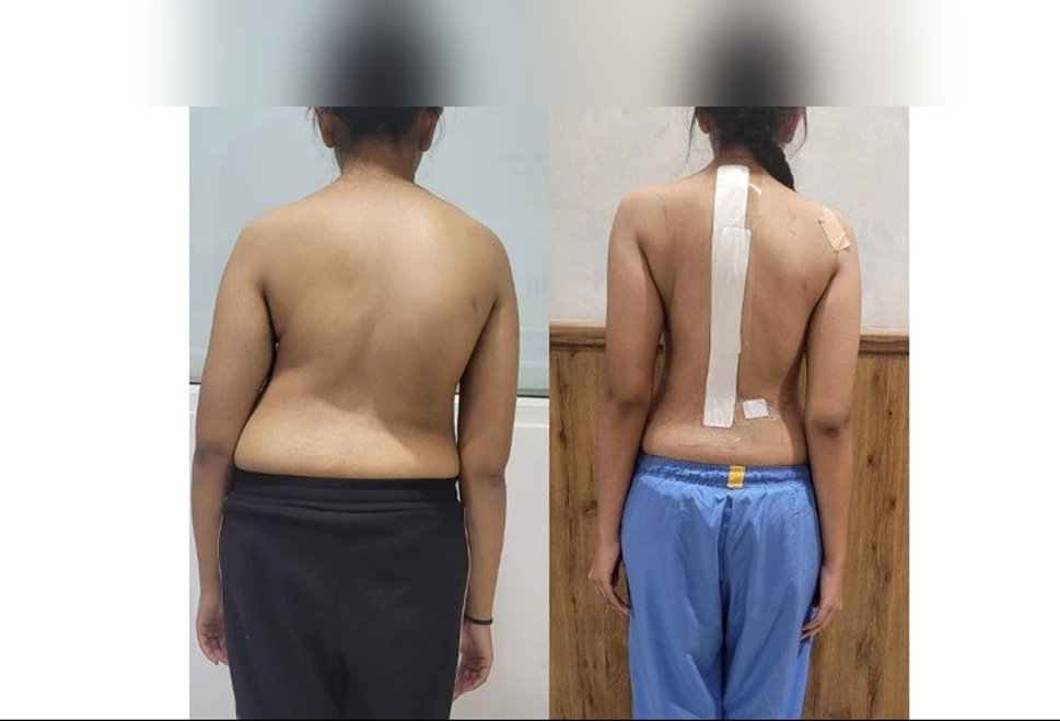 Clinical Before & After