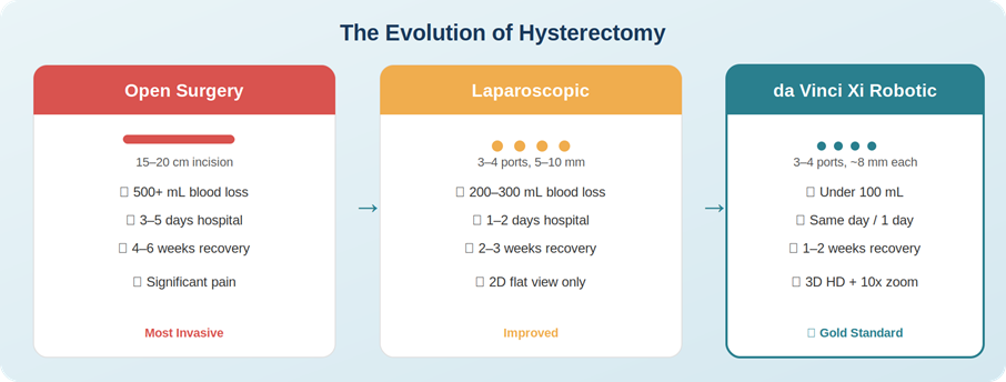 From large abdominal cuts to tiny keyhole incisions — three generations of hysterectomy surgery