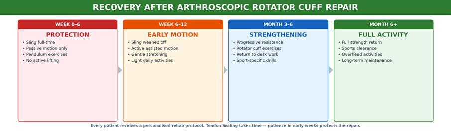 The recovery journey after arthroscopic rotator cuff repair — from sling protection through strengthening to full return to activity.
