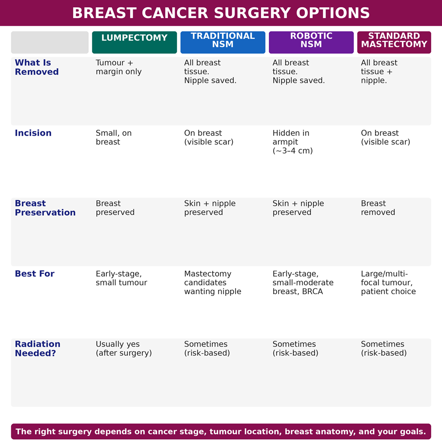 Breast cancer surgery options compared — lumpectomy, traditional NSM, robotic NSM, and standard mastectomy.