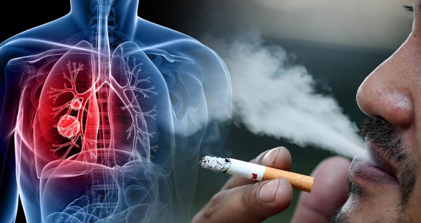 Passive Smokers and Lung cancer