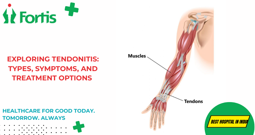 Tendonitis
