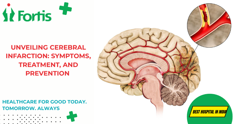 Cerebral Infarction