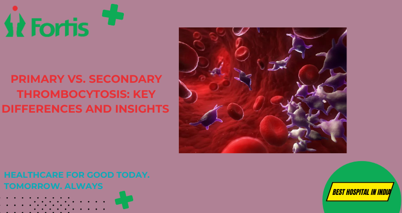 Primary vs. Secondary Thrombocytosis