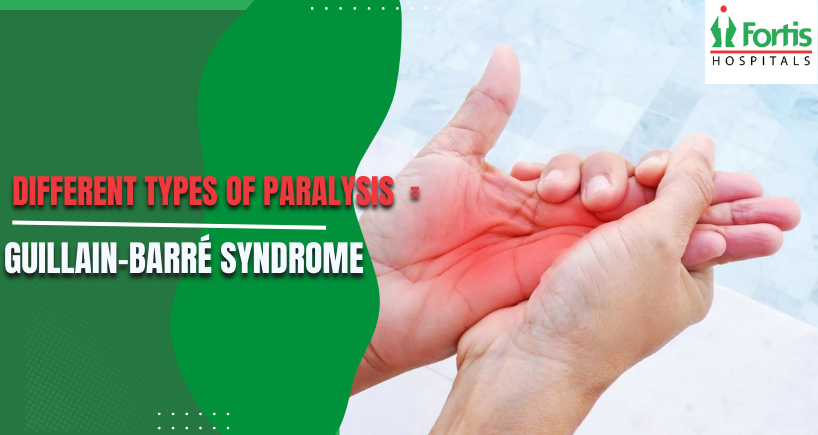 Guillain-Barré Syndrome