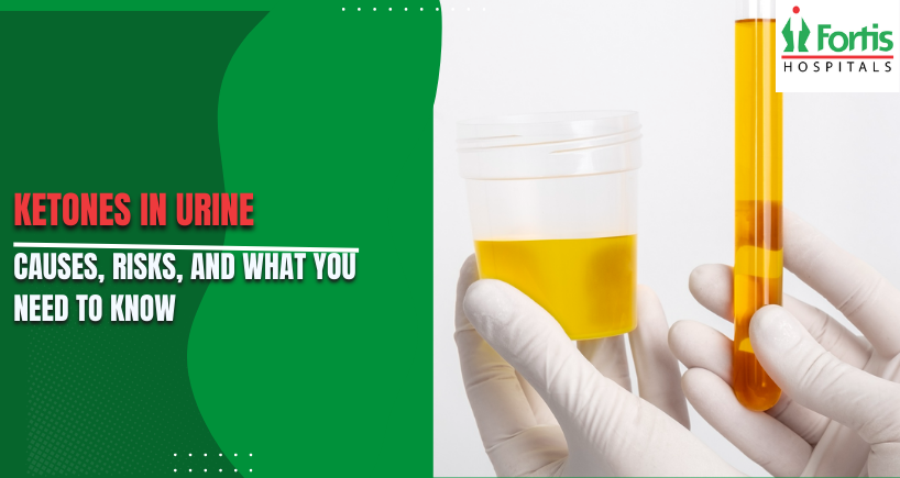 Ketones in Urine