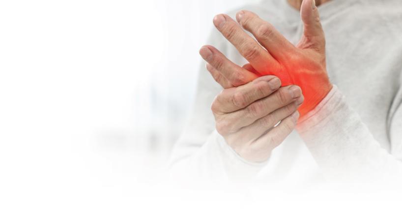 Rheumatoid Arthritis