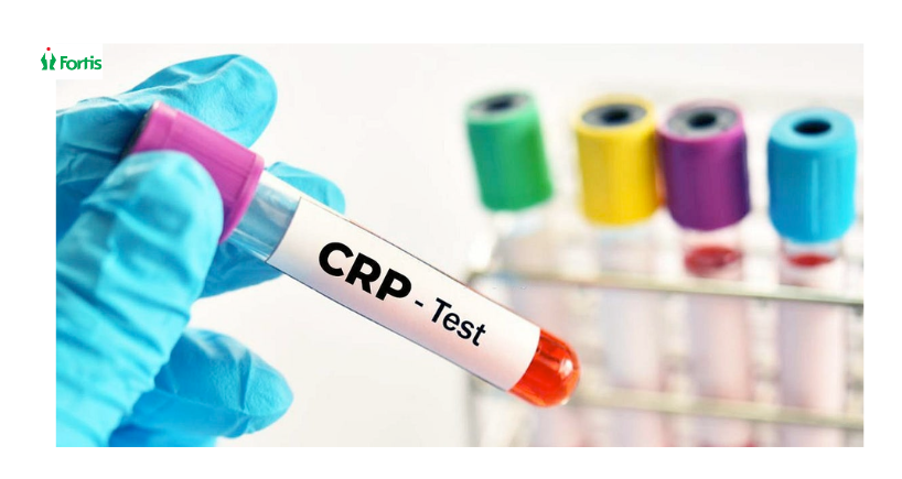 सी-रिएक्टिव प्रोटीन (CRP) टेस्ट
