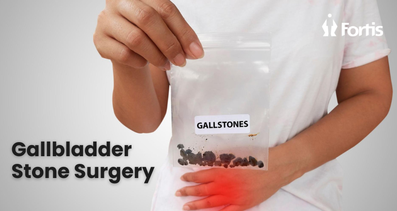 Best Gallbladder Stone Surgery in Navi Mumbai