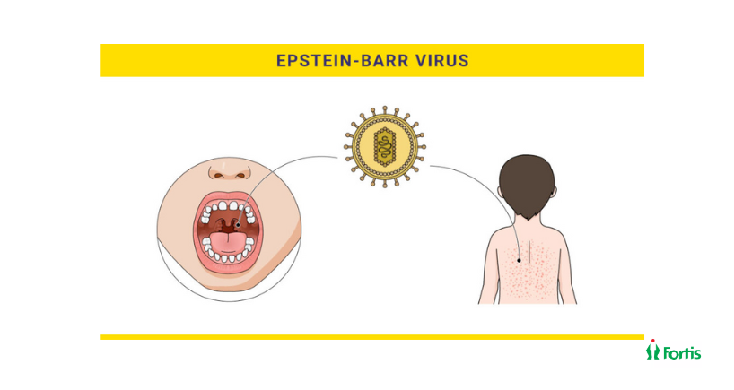 Epstein-Barr Virus