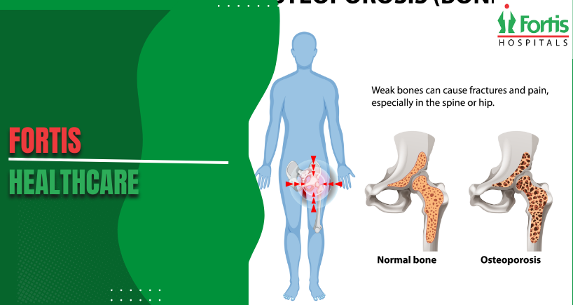 Pain Patterns in Osteosarcoma Symptoms: