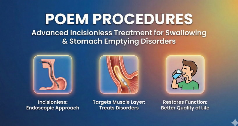 Poem Procedure 