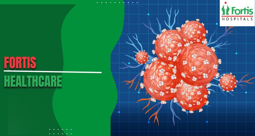 Multiple Myeloma Causes