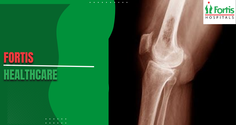 Ewing Sarcoma Treatment