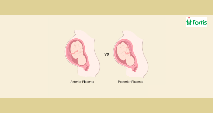 Anterior Placenta
