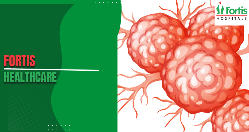 Neuroblastoma Causes 