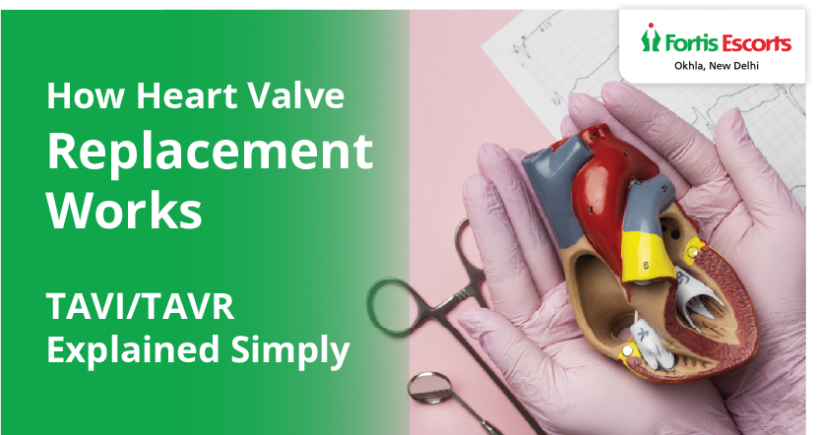 TAVI/TAVR Explained Simply