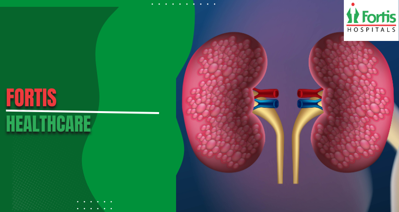 Kidney Transplants