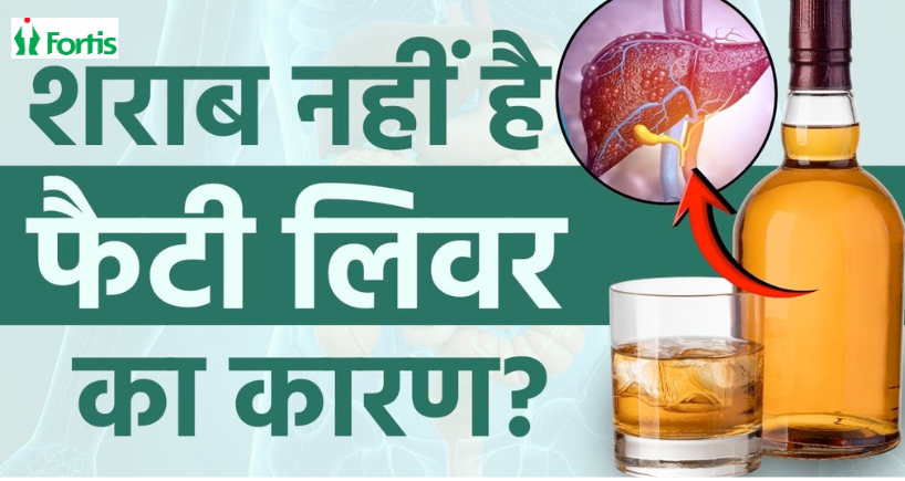 बिना शराब पिए फैटी लिवर