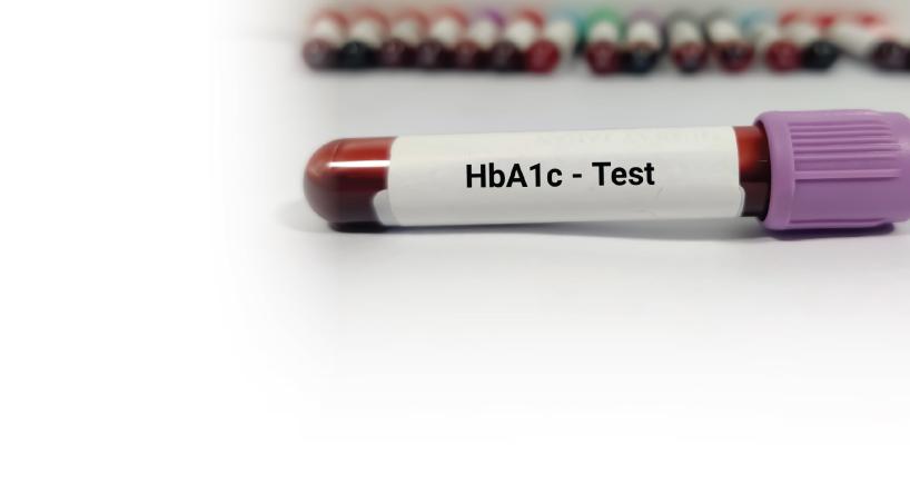 HbA1c Test