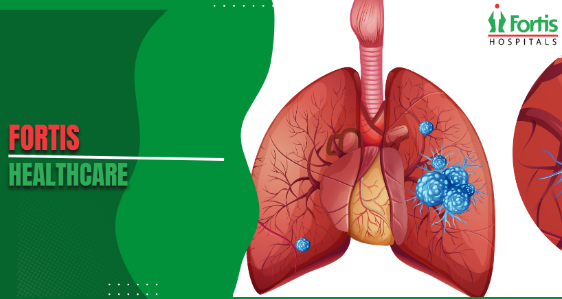 Pneumonitis 