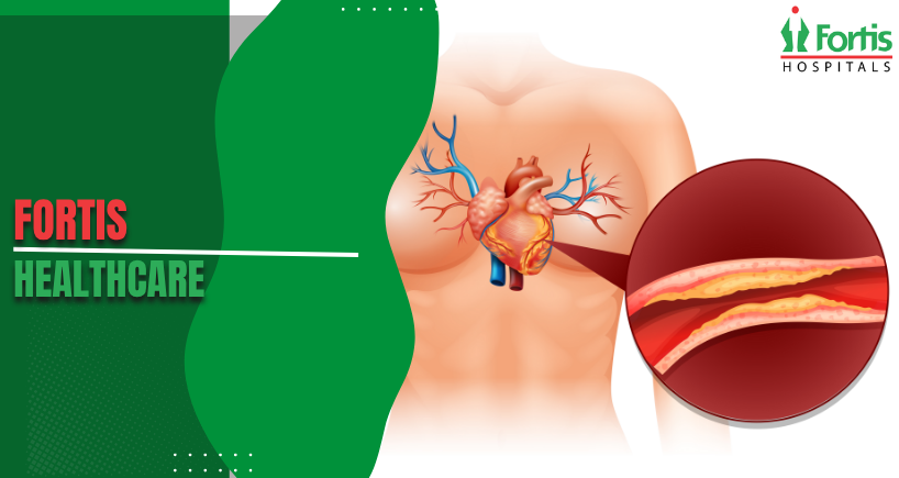 Right Atrial Enlargement