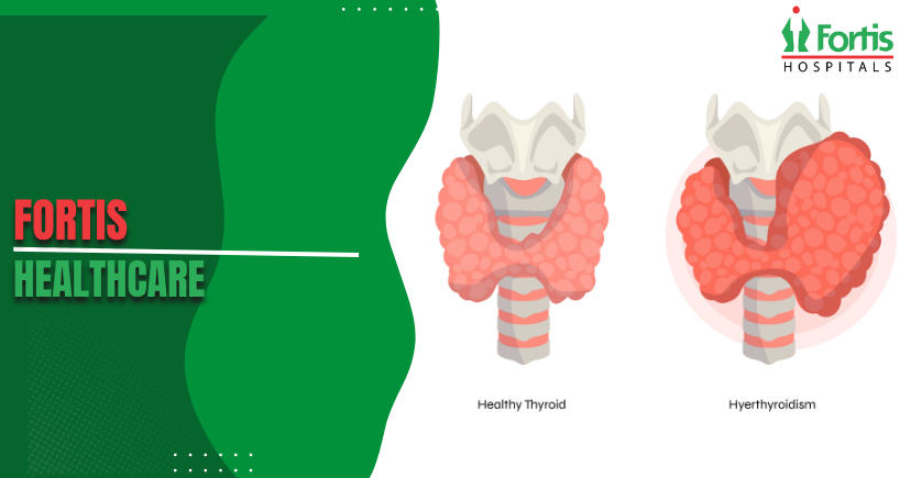 Thyroid Symptoms 