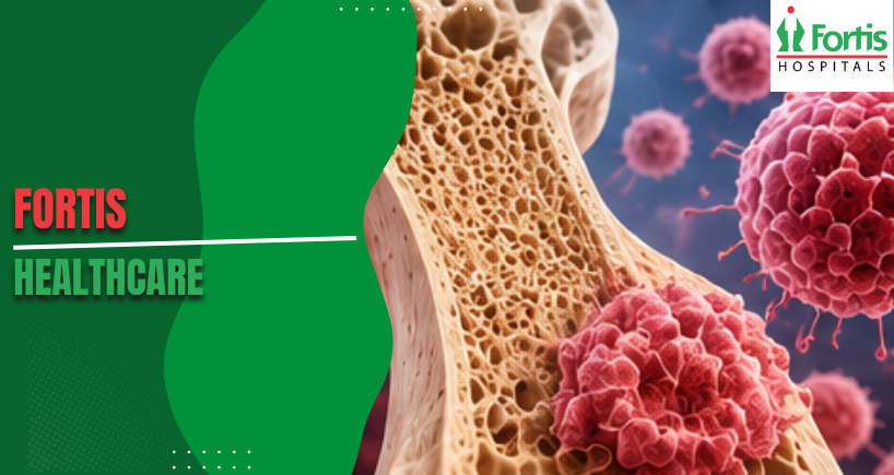 Osteosarcoma Causes