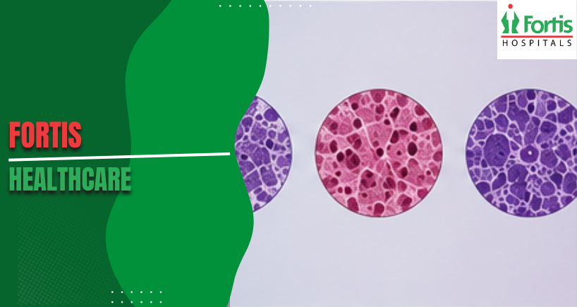 Rhabdomyosarcoma Types