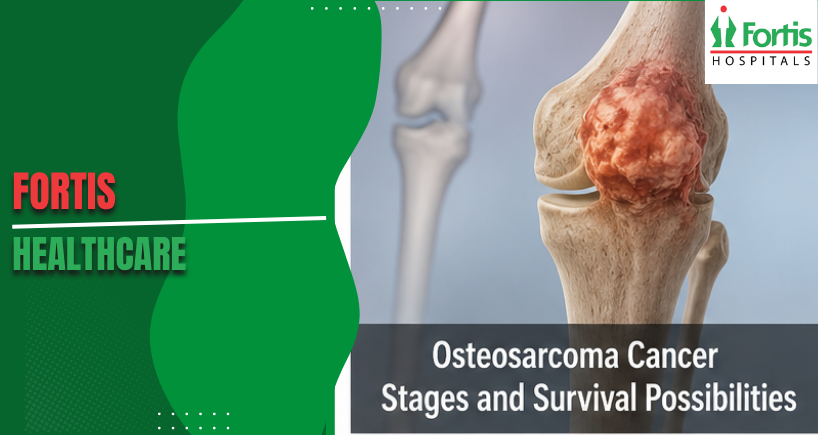 Osteosarcoma Cancer