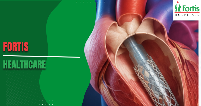 Post TAVR Complications