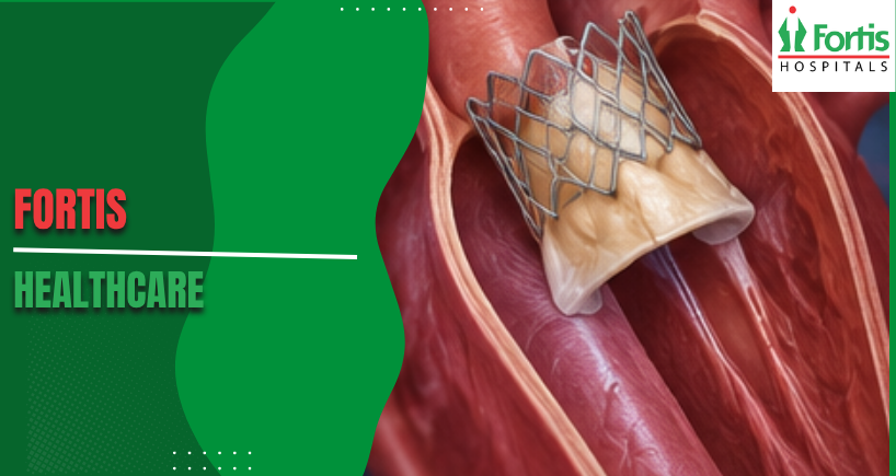 TAVR for Bicuspid Aortic Valve Disease
