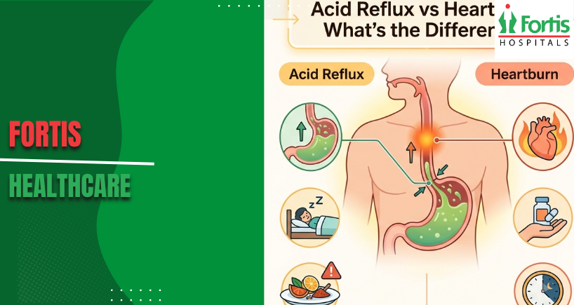 Acid Reflux vs Heartburn