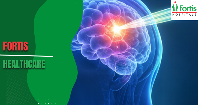 Gamma Ray Knife Surgery 