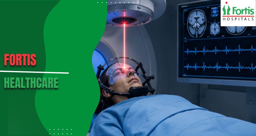 Gamma Ray Surgery for Epilepsy